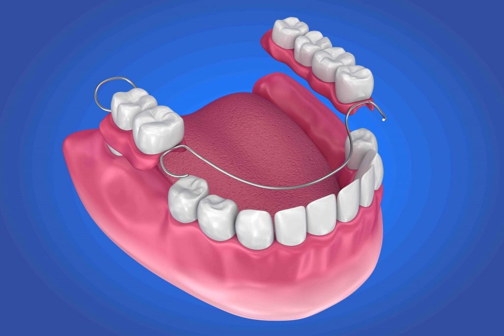 Partial Dentures in Lubbock, TX 79423